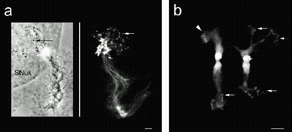 Telomeric heterochromatin of Phaseolus polytene chromosomes